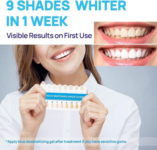 Limited Time Deal 43% OFF Teeth whitening Pens - Image 3